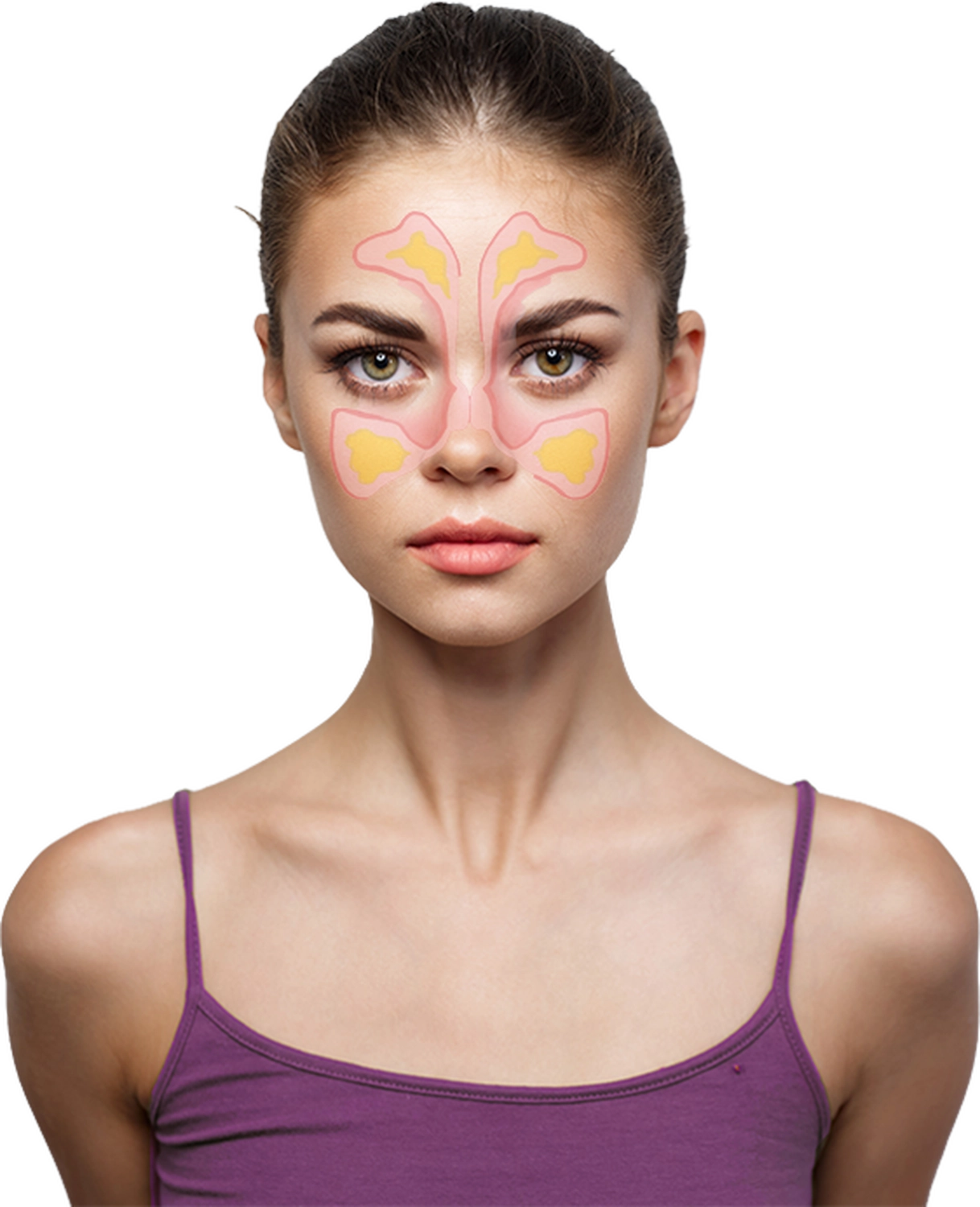 NasoStop® hilft bei diesen verstopfter Nase sowie bei Gesichts- und Kopfschmerzen.